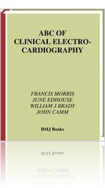 ABC of Clinical ElectroCardioGraphy